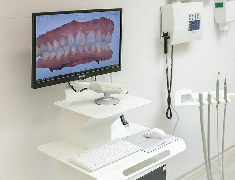 3shape digitális lenyomatvétel